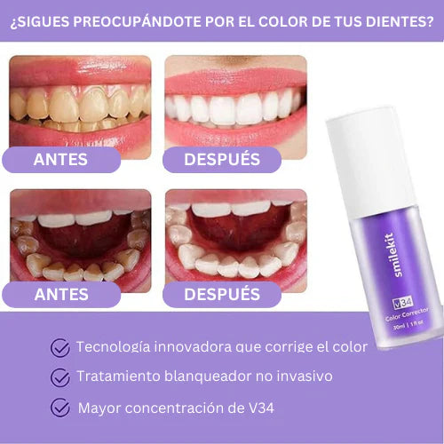 Crema Dental V34™ - TRENDFINDER® (2025)